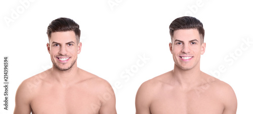 Handsome young man before and after shaving on white background