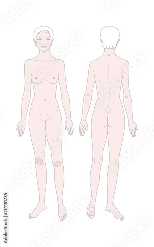 Templates of woman's figure.  Front and back views. Medical template. Vector illustration.