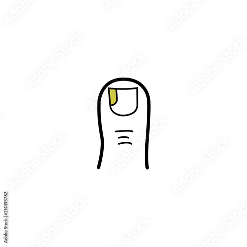 Thigh toe affected nail fungus, yellow finger nail discoloration illustration medical icon