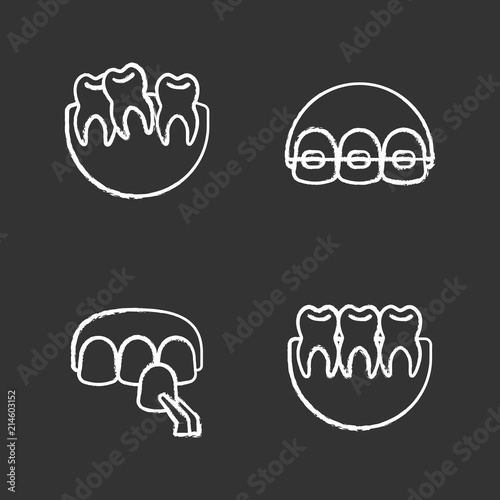 Dentistry chalk icons set
