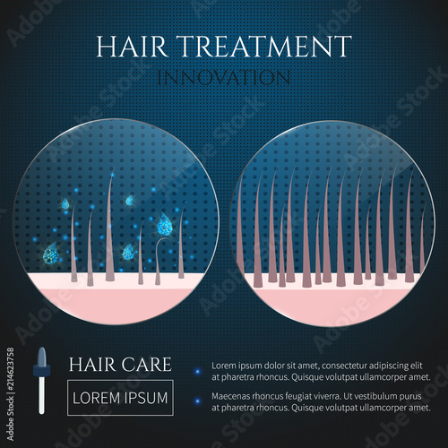Healthy and damaged hair closeup view under the microscope. Scalp care, hair treatment and strengthening concept. Perfect for trichology medical centers and clinics. Vector illustration.