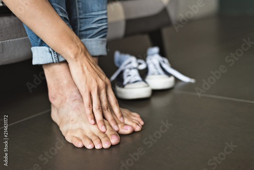 athlete's foot of woman