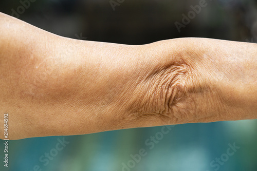Canvas Print Senior woman raising her arm and elbow on swimming pool background, Body concept