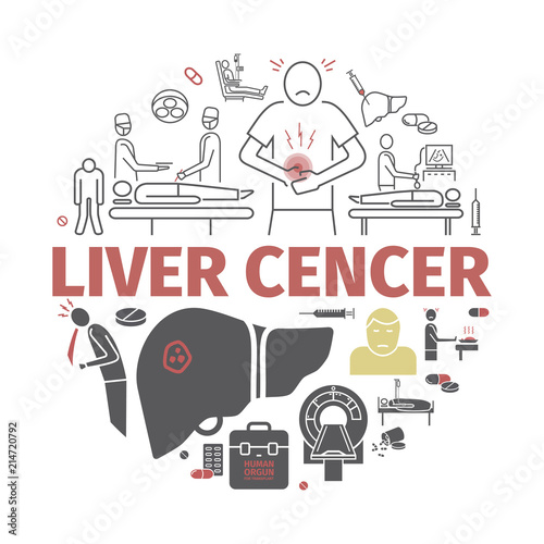 Liver Cencer. Symptoms, Causes, Treatment. Vector signs.