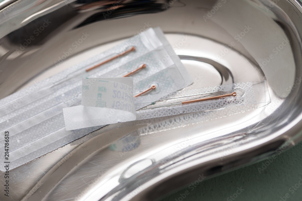Verpackte Akupunturnadeln mit Kupfergriff in Nierenschale zur TCM Akupunktur Behandlung Verpackte Akupunturnadeln mit Kupfergriff in Nierenschale zur TCM Akupunktur Behandlung