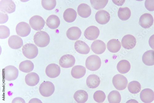 Red blood cells and platelet in blood smear, analyze by microscope 
