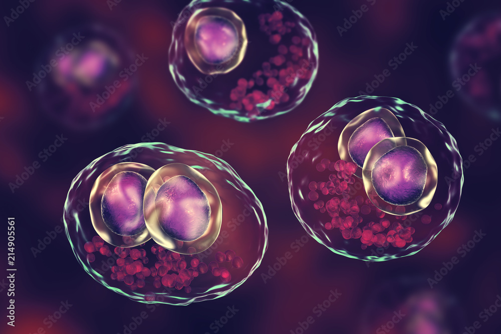 Cytomegalovirus CMV in human cell, owl's eye inclusion in nucleus, multinucleated cell, 3D illustration. It is herpes virus, causes disease in fetus, organ transplant patients, HIV infected people