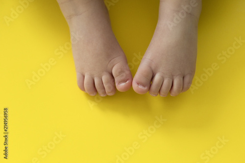Принти на полотні ingrowing baby nails. pedicure