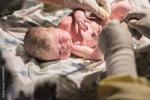 Wallpaper Mural Brand new baby laying under examination table lights with nurses hands visible Torontodigital.ca