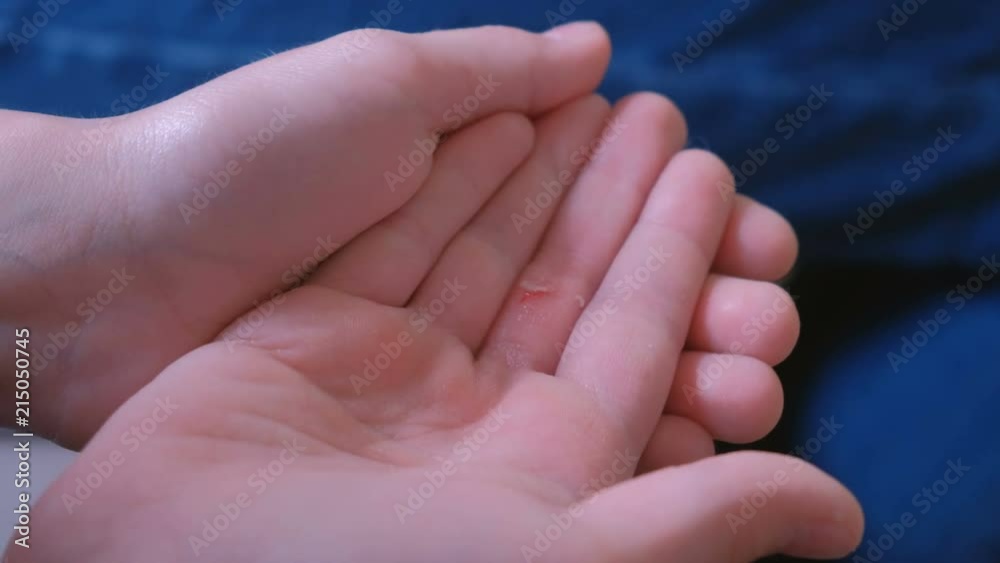 Mom processes the cut on the finger of her child with an alcohol napkin. Hands close-up. Mom processes the cut on the finger of her child with an alcohol napkin. Hands close-up.