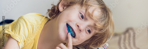 Fotografi Three-year old boy shows myofunctional trainer to illuminate mouth breathing habit