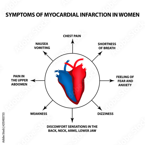 Symptoms of myocardial infarction in women. A heart attack. World Heart Day. Vector illustration on isolated background