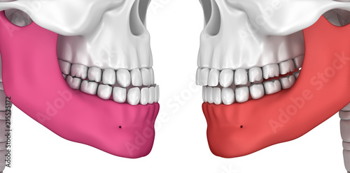 Occlusion: Overjet and Overbite, 3D illustration .