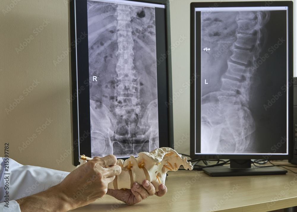 A neurosurgeon  pointing at lumbar vertebra model in medical office