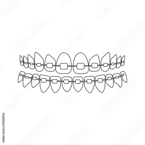 Teeth with braces