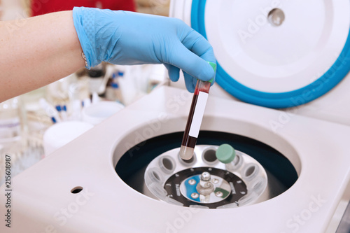 Tableau sur toile Tube of blood is placed in a centrifuge for plasma lifting