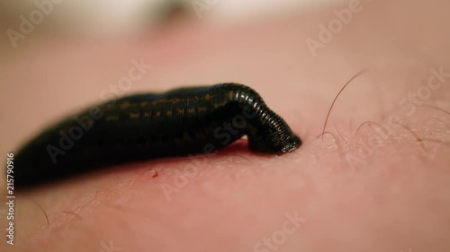Treatment with leeches feet. Hirudotherapy in clinic - Leech on skin. Close up. Macro. 4K