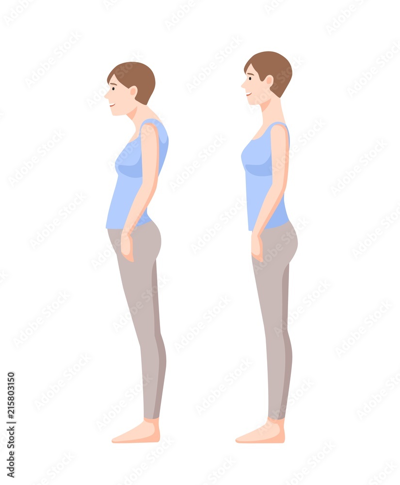 Young smiling woman standing in good and bad postures isolated on white background. Neutral spine, correct and incorrect poses. Side view. Colorful vector illustration in flat cartoon style. Young smiling woman standing in good and bad postures isolated on white background. Neutral spine, correct and incorrect poses. Side view. Colorful vector illustration in flat cartoon style.