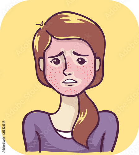 Symptom Severe Blushing Illustration