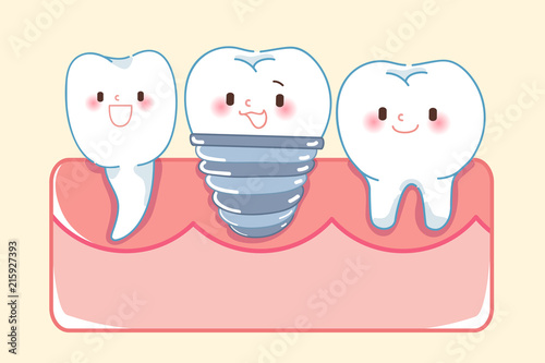 cute cartoon implant tooth