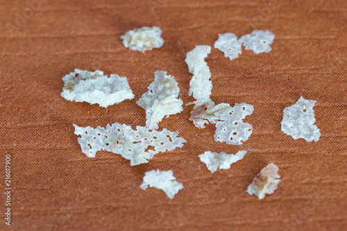 Close-up for human dandruff flakes. photo