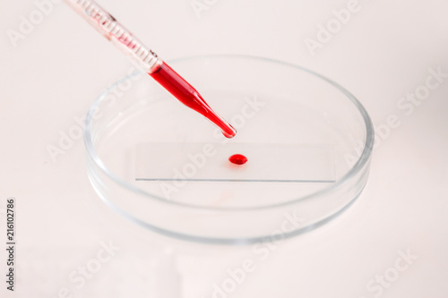 Working with blood sample in laboratory, closeup