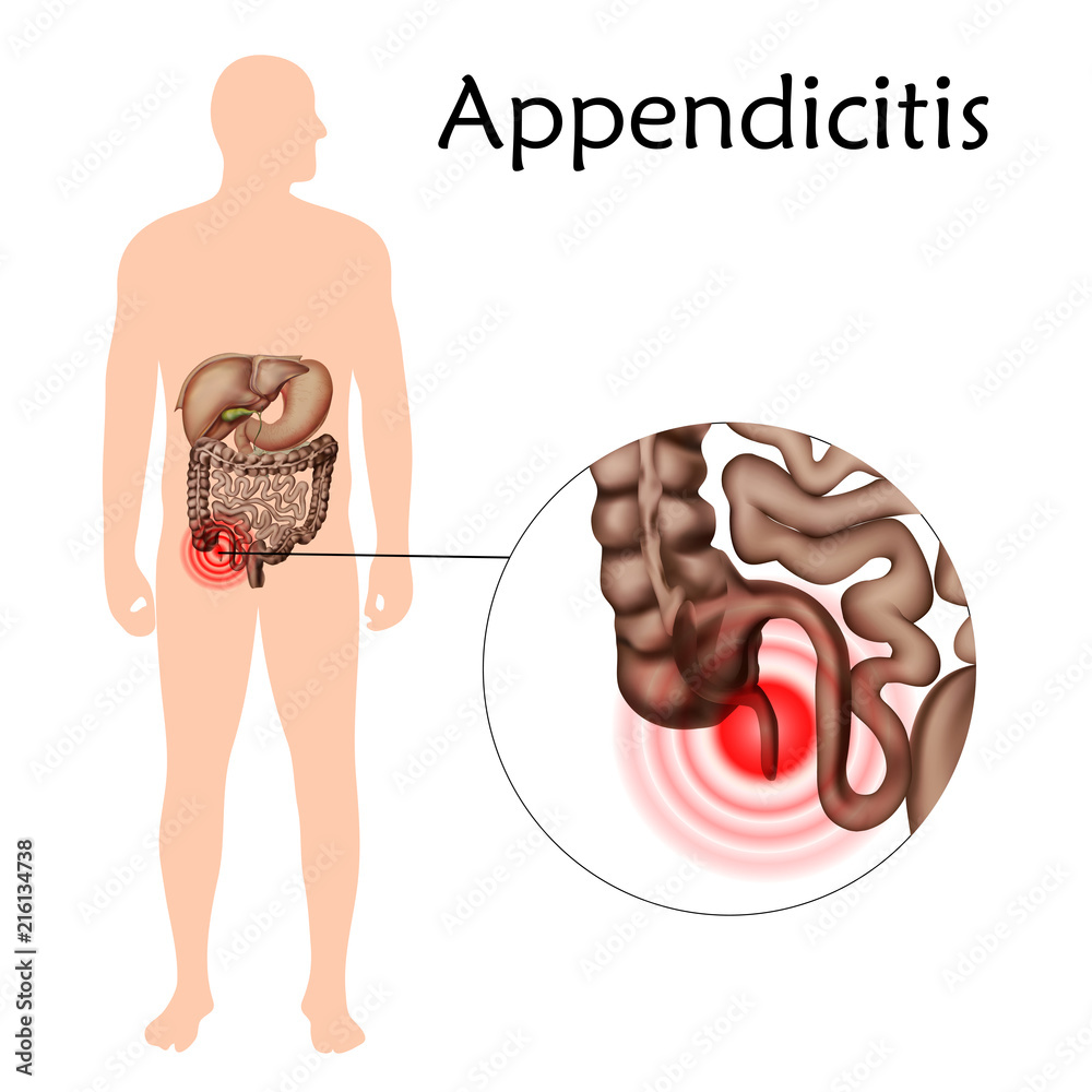 Anatomy Of Human Body Appendix
