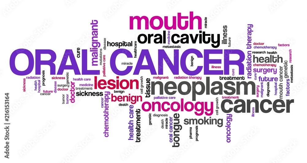 Fototapeta premium Oral cancer