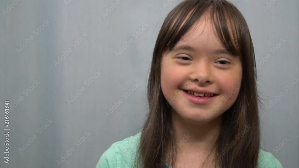 Down syndrome girl smiling on white background Down syndrome girl smiling on white background