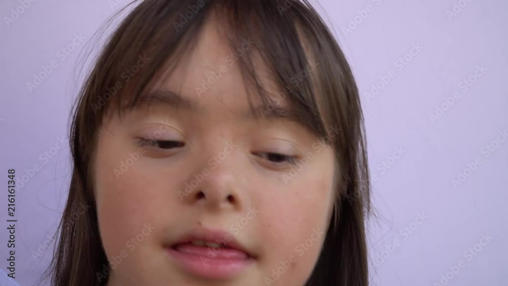 Down syndrome girl smiling on white background Down syndrome girl smiling on white background