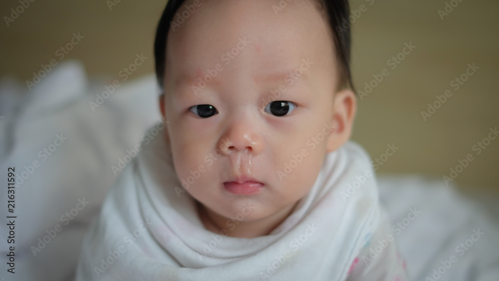 The Asian boy have a cold with snot. The Asian boy have a cold with snot.