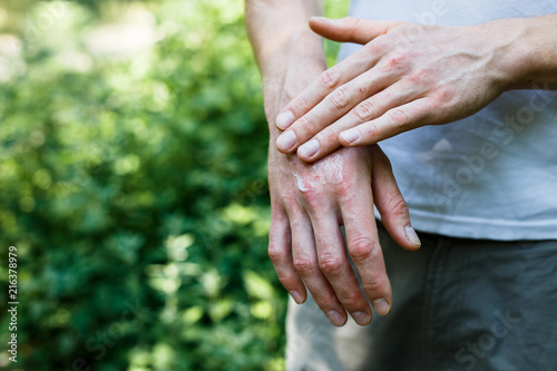 Ointment on hand. Applying the ointment in the treatment and hydration of the skin.Psoriasis skin. Horizontal photo. Copy space on green background photo