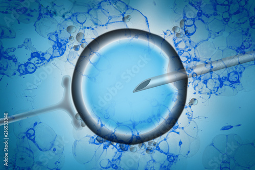 Assisted reproductive technology in fertility treatment