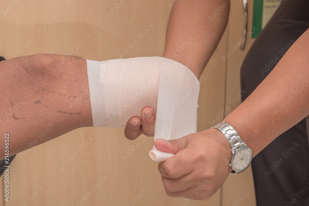 below knee stump bandaging, amputee BKA with prothesis preparing Stock