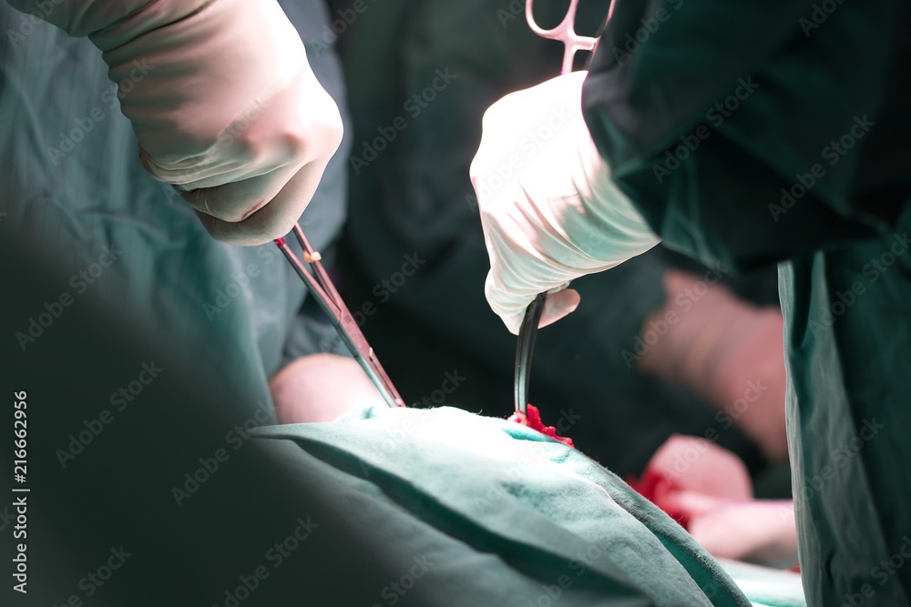 Doctors hand during surgery in the operating room close up views Doctors hand during surgery in the operating room close up views