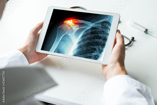 Doctor watching-a-x-ray of broken shoulder with pain on digital tablet. Radiology concept photo