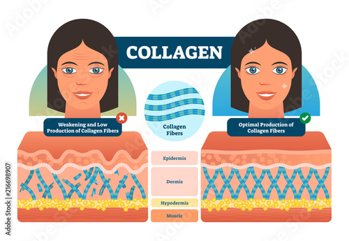 Collagen vector illustration. Medical and anatomical labeled scheme with fibers, epidermis, hypodermis and muscle. Weakening low and optimal production compared diagram.