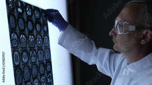 Senior doctor looking at chest x-ray in office.