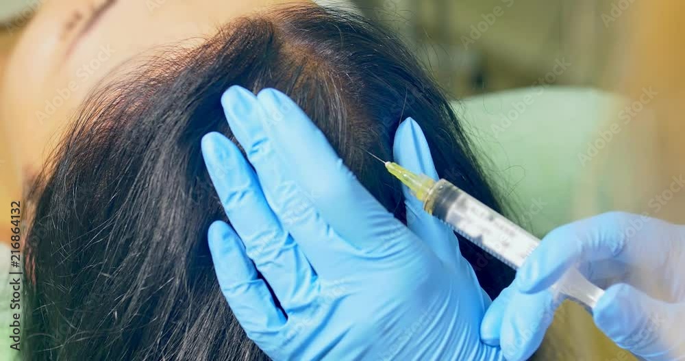 Cosmetologist makes injection of vitamins and minerals in the scalp ...