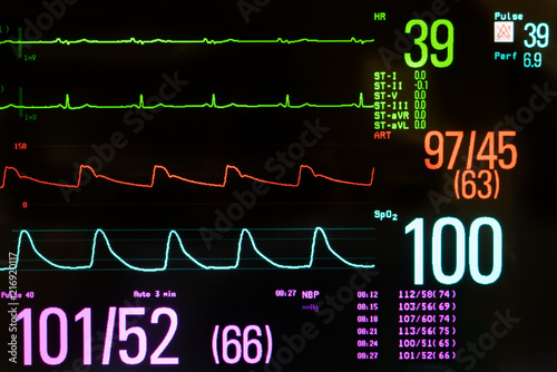 Medical Monitor Showing Bradycardia, Hypotension and Oxygen Saturation. photo