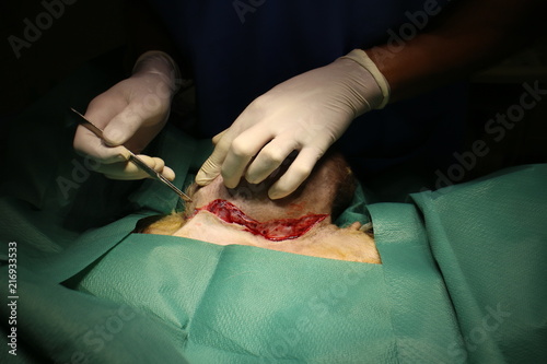 Hands with scalpel and big tumor on mammary gland by german shepherd dog 