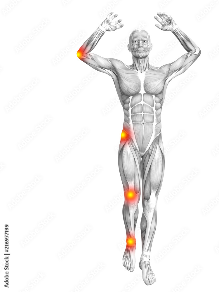 Conceptual human muscle anatomy with red and yellow hot spot inflammation or articular joint pain for health care therapy or sport concepts. 3D illustration man arthritis or bone osteoporosis disease Conceptual human muscle anatomy with red and yellow hot spot inflammation or articular joint pain for health care therapy or sport concepts. 3D illustration man arthritis or bone osteoporosis disease