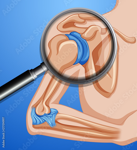A human shoulder joints