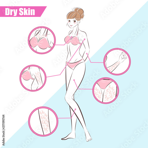 woman with dry skin concept