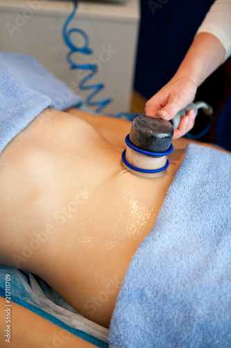 Young women having stomach suction pump massage vacuum health treatment by Beautician in Spa salon