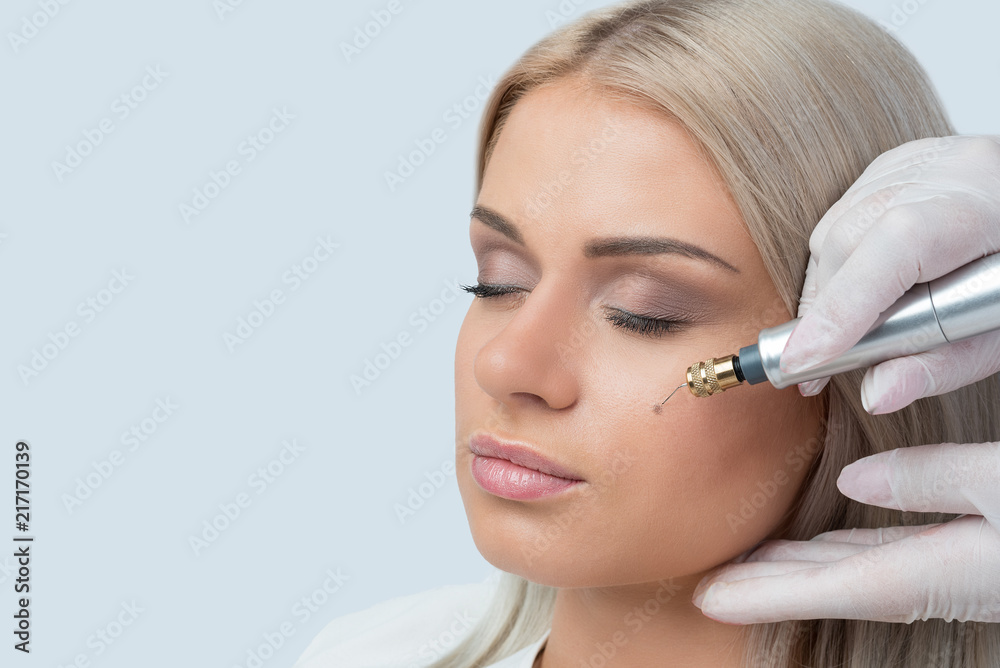 Fibroblast skin care procedure, wrinkle eyelids lifting. Fibroblast skin care procedure, wrinkle eyelids lifting.