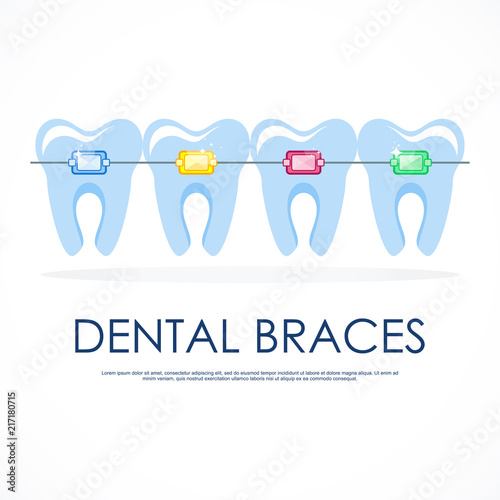 Healthy well-groomed teeth in braces. Dentistry and oral care. Flat vector cartoon illustration. Objects isolated on white background.