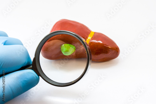 фотографія Diagnosis of gallbladder for presence of disease