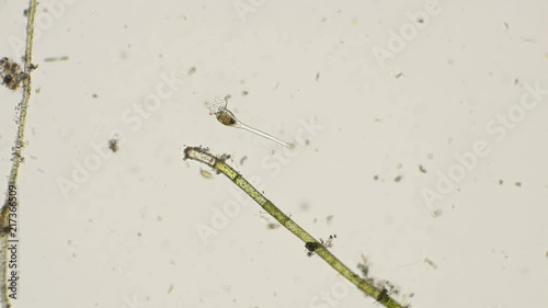 rotifer is kind of like a genus of Collotheca ornata, under a microscope photo