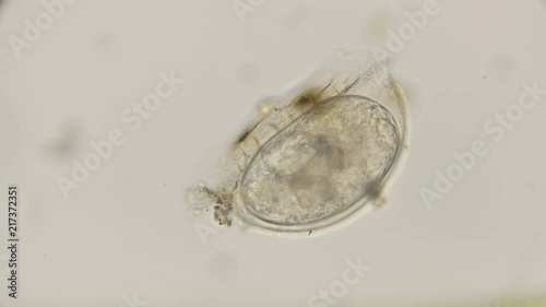 egg creeping Rotatoria under a microscope photo